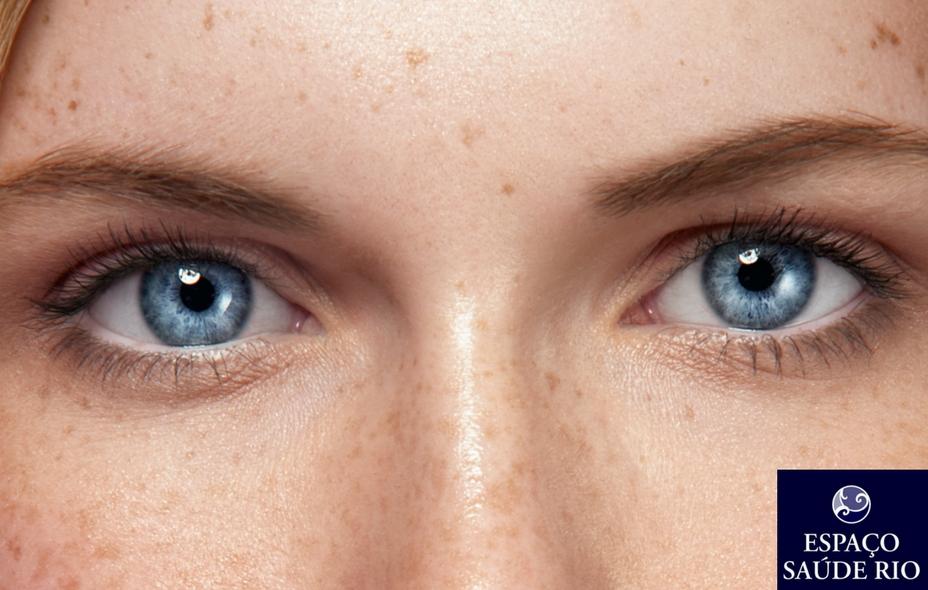7 Dicas Para Ter Menos Manchas 1