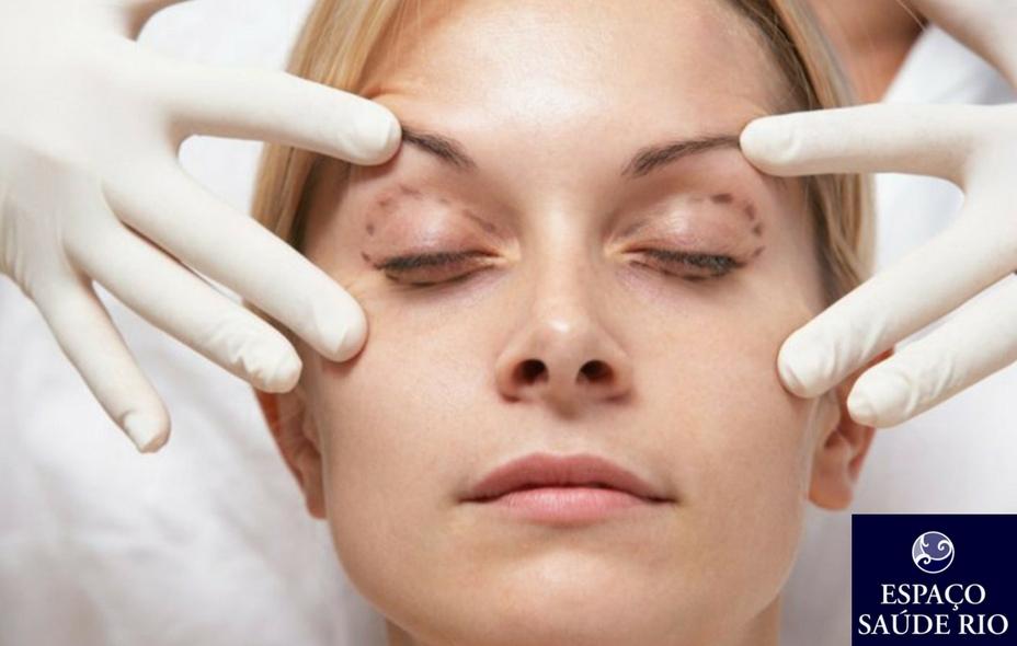 Queda Da Palpebra Após Toxina Botulinica 1
