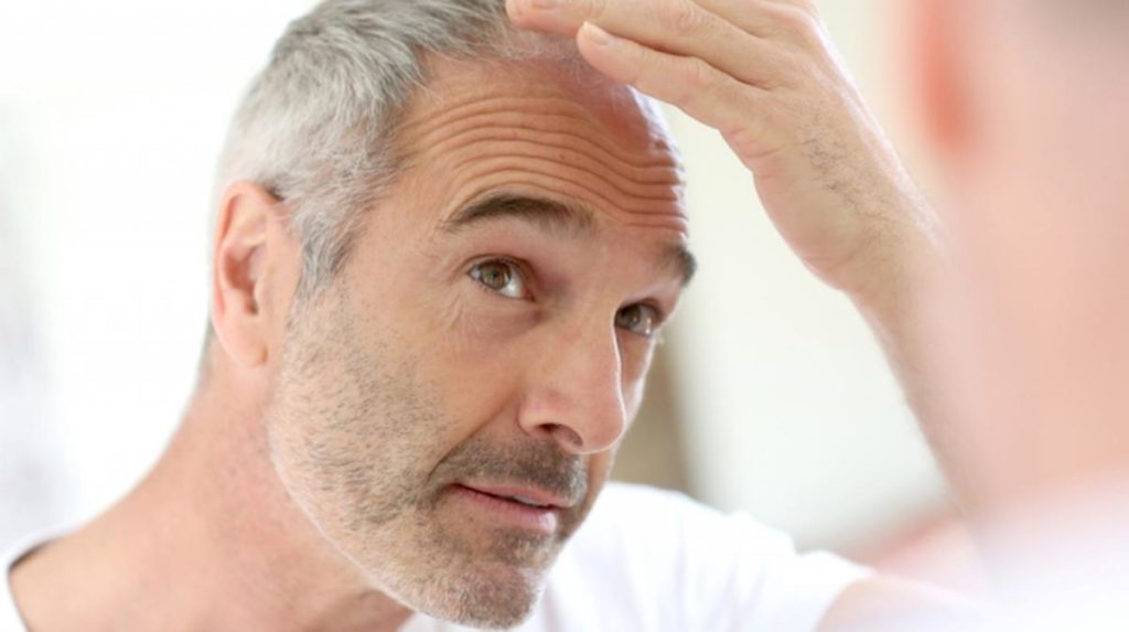 Como Acabar Com A Queda De Cabelo3 1 1024x573