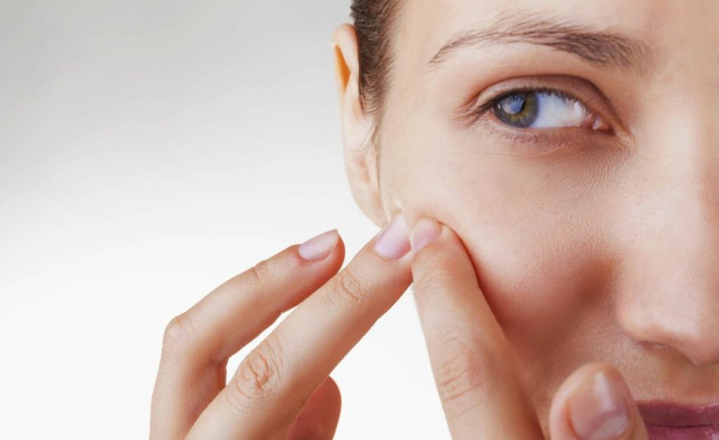 Dicas Evitar Acne 467093369 1 1024x626