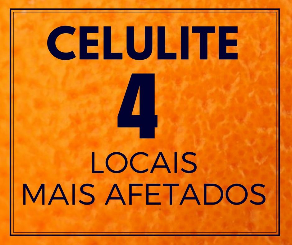celulite locais mais afetados