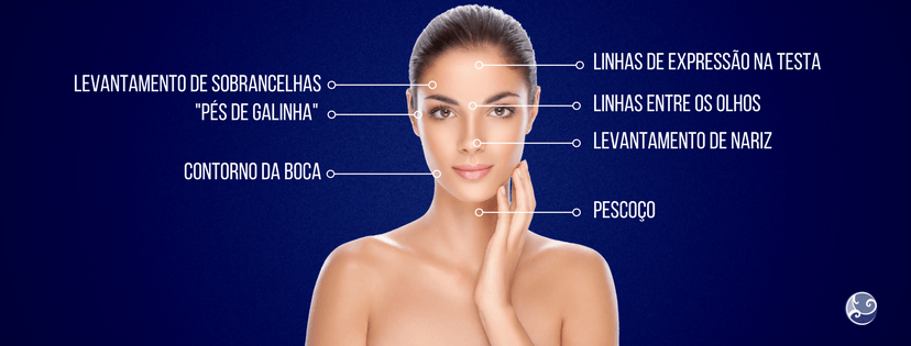 botox-areas-do-rosto