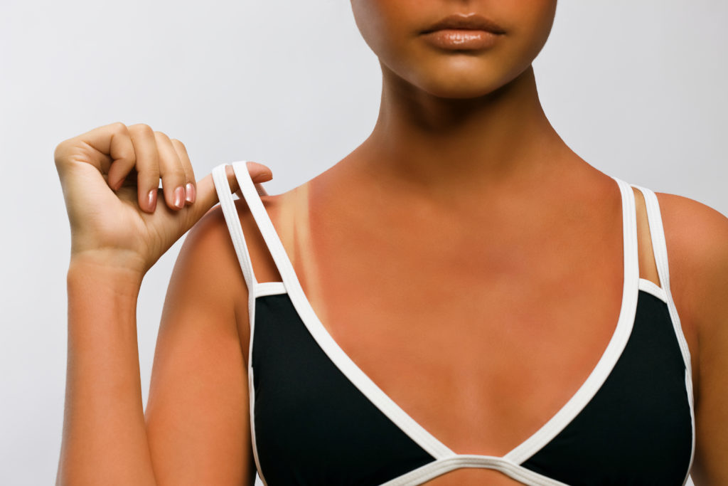 Canva Sunburn Beauty Portrait 1024x683