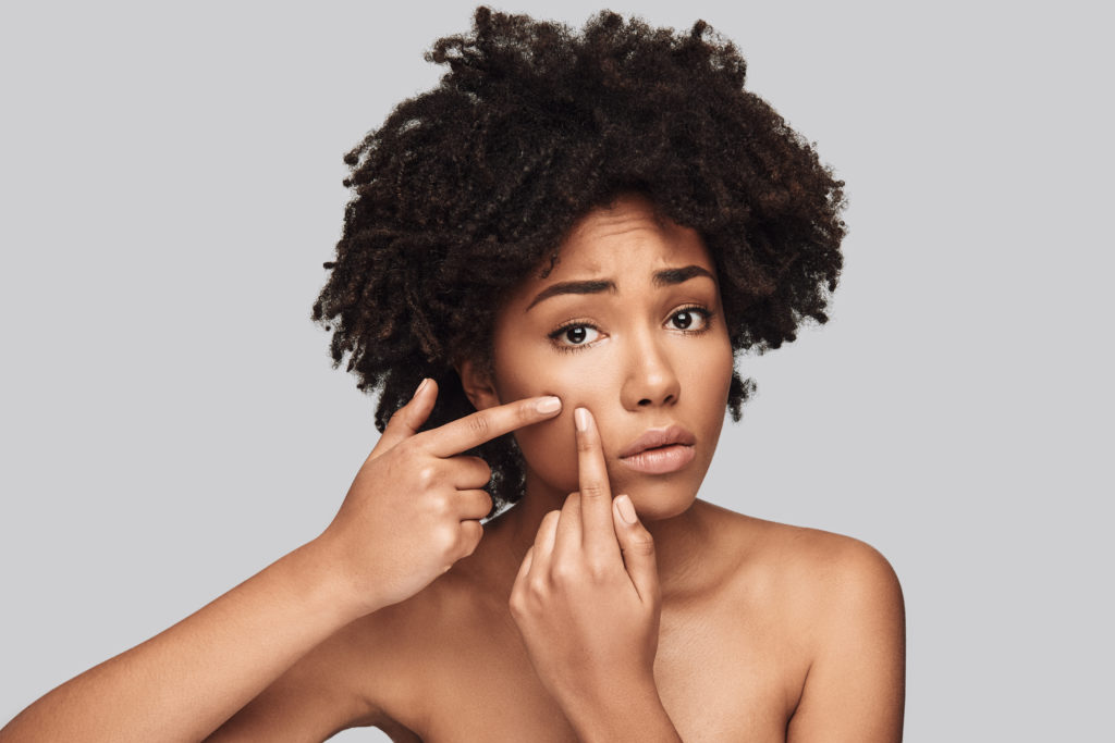 Canva Another Acne. 1024x683